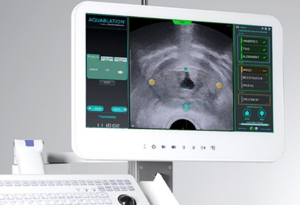 西威科智能科技积极推广美国AQUABEAM水刀机器人